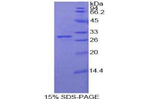 SDS-PAGE analysis of Human Protocadherin beta 2 Protein.
