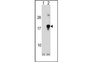 Western blot analysis of HMGN3 (arrow) using HMGN3 / TRIP7 Antibody (N-term) Cat. (HMGN3 抗体  (N-Term))