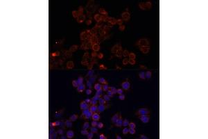 Immunofluorescence analysis of HeLa cells using MTOR antibody (ABIN6292920) at dilution of 1:100. (MTOR 抗体)