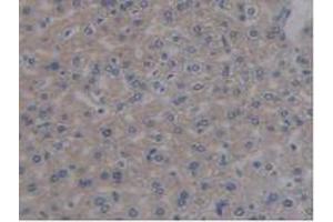 IHC-P analysis of Mouse Liver Tissue, with DAB staining. (REG3B 抗体  (AA 27-175))