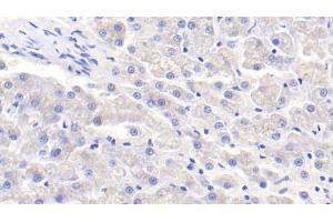 Detection of APOE in Canine Liver Tissue using Polyclonal Antibody to Apolipoprotein E (APOE) (APOE 抗体  (AA 1-172))