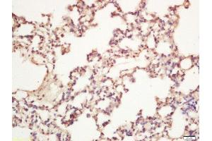 Formalin-fixed and paraffin embedded rat lung labeled with Rabbit Anti-AMBRA1 Polyclonal Antibody, Unconjugated 1:200 followed by conjugation to the secondary antibody and DAB staining (AMBRA1 抗体  (AA 221-320))