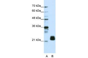 WB Suggested Anti-TMED4 Antibody Titration:  1. (TMED4 抗体  (N-Term))