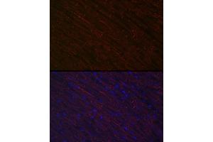 Immunofluorescence analysis of rat heart using Desminmin Rabbit pAb (ABIN3021114, ABIN3021115, ABIN3021116 and ABIN6213957) at dilution of 1:100 (40x lens).