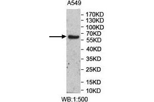 Western Blotting (WB) image for anti-UDP Glucuronosyltransferase 2 Family, Polypeptide A3 (UGT2A3) antibody (ABIN1856379) (UGT2A3 抗体)