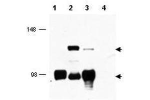 Western blot using  affinity purified anti-MECT1 antibody shows detection of endogenous MECT1 (lower arrowhead) and MECT1-MAML2 fusion protein (top arrowhead) in cell lysates. (CRTC1 抗体  (AA 19-34))