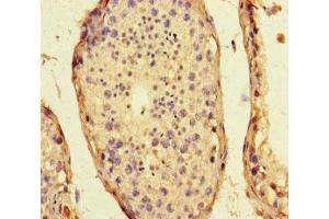 Immunohistochemistry of paraffin-embedded human testis tissue using ABIN7169848 at dilution of 1:100 (SMIM1 抗体  (AA 1-46))