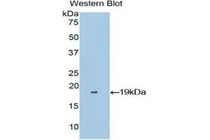Western blot analysis of the recombinant protein. (Periostin 抗体  (AA 500-630))