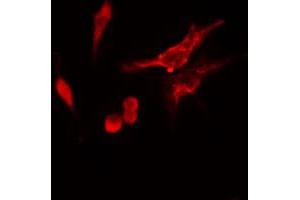 ABIN6274747 staining HeLa cells by IF/ICC. (RPS11 抗体  (C-Term))