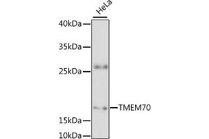 Western blot analysis of extracts of HeLa cells, using TMEM70 antibody (ABIN6133460, ABIN6149268, ABIN6149269 and ABIN6217808) at 1:3000 dilution. (Transmembrane Protein 70 (TMM70) (AA 161-260) 抗体)