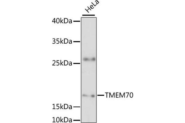 Transmembrane Protein 70 (TMM70) (AA 161-260) 抗体