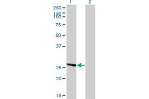 Western Blot analysis of IDI1 expression in transfected 293T cell line by IDI1 monoclonal antibody (M01), clone 6G10. (IDI1 抗体  (AA 175-283))