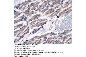 Human Muscle (ZNF391 抗体  (N-Term))