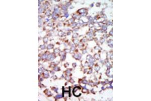 Immunohistochemistry (IHC) image for anti-Nuclear Receptor Subfamily 2, Group C, Member 2 (NR2C2) antibody (ABIN3003597) (TR4 抗体)