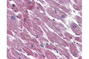 Anti-ADCYAP1R1 antibody IHC of human heart.