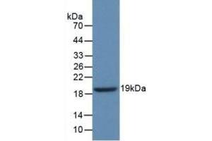 Detection of Recombinant GbA, Human using Polyclonal Antibody to Glucocerebrosidase (GBA) (GBA 抗体  (AA 334-498))