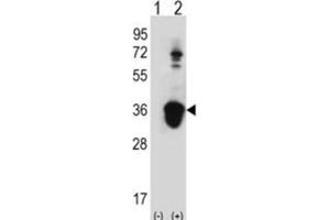 Western Blotting (WB) image for anti-U2 Small Nuclear RNA Auxiliary Factor 1 (U2AF1) antibody (ABIN3001638) (U2AF1 抗体)