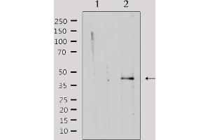 Western blot analysis of extracts from rat muscle, using KAPCG Antibody. (PRKACG 抗体)