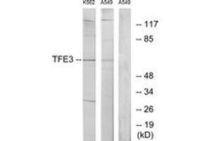 Western blot analysis of extracts from K562/A549 cells, using TFE3 Antibody. (TFE3 抗体  (AA 101-150))