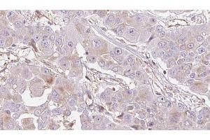 Immunohistochemistry (IHC) image for anti-Olfactory Receptor, Family 1, Subfamily E, Member 2 (OR1E2) (C-Term) antibody (ABIN6263844)