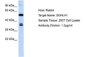 Host: Rabbit Target Name: SOHLH1 Sample Type: 293T Whole Cell lysates Antibody Dilution: 1. (SOHLH1 抗体  (C-Term))