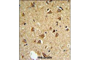 Immunohistochemistry (IHC) image for anti-Deiodinase, Iodothyronine, Type II (DIO2) (AA 165-191) antibody (ABIN5531011)