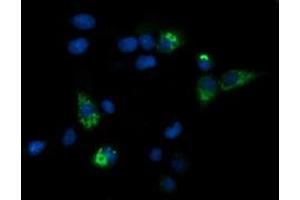Image no. 2 for anti-Carboxypeptidase A2 (Pancreatic) (CPA2) antibody (ABIN1497597) (Carboxypeptidase A2 抗体)