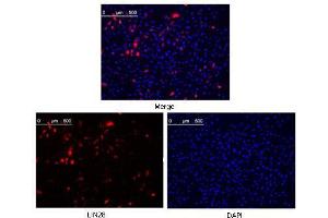 Confocal immunofluorescence analysis of methanol fixed Hela cells were transfected with pMX construct of human LIN28, cells were analyzed ~62 hours after transfection. (LIN28A 抗体  (AA 93-209))
