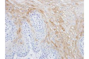 IHC-P Image Immunohistochemical analysis of paraffin-embedded Tw2. (MRGPRX4 抗体  (C-Term))