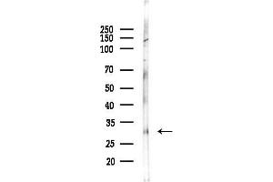 Western blot analysis of lysates from PC12 cells, using CLEC12A Antibody at 1/1000 dilution.