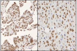 Immunohistochemistry (IHC) image for anti-Heterogeneous Nuclear Ribonucleoprotein K (HNRNPK) (AA 1-50) antibody (ABIN7454658)