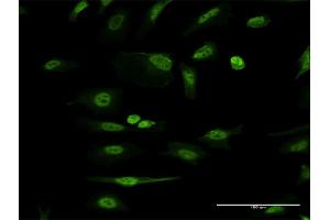 Immunofluorescence of monoclonal antibody to ITGB1BP1 on HeLa cell. (ITGB1BP1 抗体  (AA 1-200))