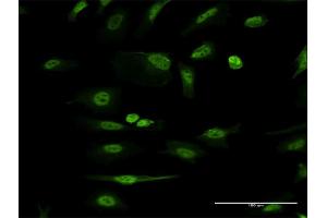 Immunofluorescence of monoclonal antibody to ITGB1BP1 on HeLa cell.