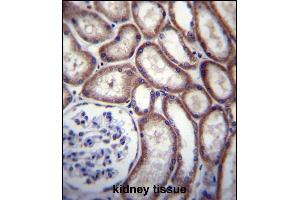 Immunohistochemistry (Paraffin-embedded Sections) (IHC (p)) image for anti-DnaJ (Hsp40) Homolog, Subfamily C, Member 27 (DNAJC27) (AA 1-30), (N-Term) antibody (ABIN656683)