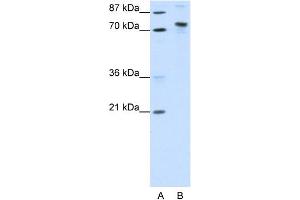 WB Suggested Anti-KIAA0737 Antibody Titration:  1. (TOX4 抗体  (N-Term))