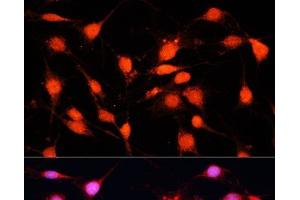 Immunofluorescence analysis of C6 cells using METTL3 Polyclonal Antibody at dilution of 1:100 (40x lens). (METTL3 抗体)