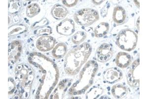 Detection of GAL2 in Human Kidney Tissue using Monoclonal Antibody to Galectin 2 (GAL2) (Gallinacin-2 (GAL2) (AA 1-132) 抗体)