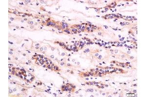 Formalin-fixed and paraffin embedded human kidney labeled with Anti-GM2A Polyclonal Antibody, Unconjugated  at 1:200 followed by conjugation to the secondary antibody and DAB staining (GM2A 抗体  (AA 131-193))
