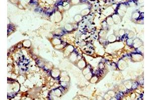 Immunohistochemistry of paraffin-embedded human small intestine tissue using ABIN7152503 at dilution of 1:100