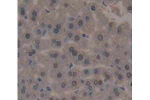 Used in DAB staining on fromalin fixed paraffin- embedded Kidney tissue (POLA1 抗体  (AA 1209-1465))
