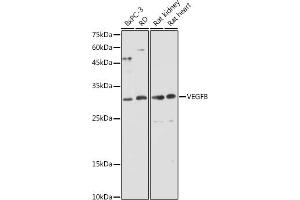 Western blot analysis of extracts of various cell lines, using VEGFB antibody (ABIN6128909, ABIN6150090, ABIN6150092 and ABIN6216417) at 1:1000 dilution. (VEGFB 抗体  (AA 25-207))