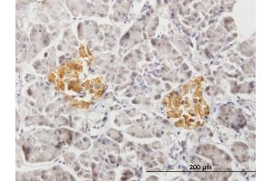 Immunostaining (ISt) image for anti-Protein tyrosine Phosphatase, Receptor Type, N Polypeptide 2 (PTPRN2) (AA 1-986) antibody (ABIN519526)