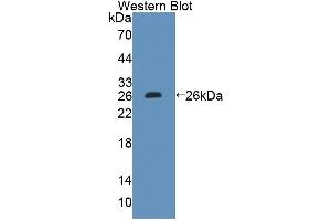 Western Blotting (WB) image for anti-Cytochrome P450, Family 11, Subfamily A, Polypeptide 1 (CYP11A1) (AA 329-526) antibody (ABIN5013425)