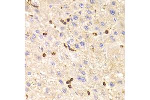 Immunohistochemistry of paraffin-embedded Human liver using LSP1 antibody at dilution of 1:100 (x400 lens). (LSP1 抗体)
