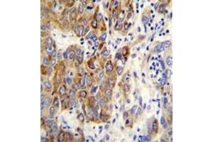 Immunohistochemistry (Paraffin-embedded Sections) (IHC (p)) image for anti-Cytochrome P450, Family 2, Subfamily B, Polypeptide 6 (CYP2B6) (AA 242-270), (Middle Region) antibody (ABIN951782)