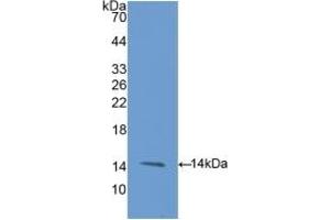 Detection of Recombinant ENG, Rat using Polyclonal Antibody to Endoglin (ENG) (Endoglin 抗体  (AA 26-136))