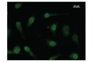 Immunostaining analysis in HeLa cells. (FBXO18 抗体)