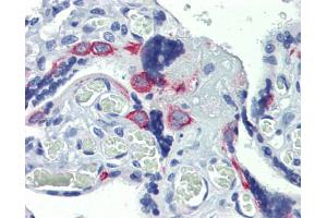 Human placenta; Anti-ZNF71 antibody IHC staining of human placenta. (ZNF71 抗体)