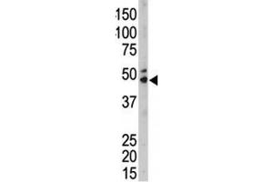 The SPHK1 antibody used in western blot to detect SPHK1 in mouse kidney tissue lysate (SPHK1 抗体  (AA 286-315))