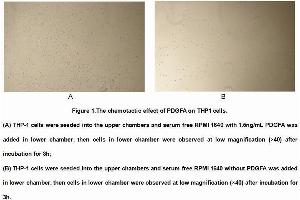 Image no. 3 for Platelet Derived Growth Factor A (PDGFA) (AA 94-194) (Active) protein (His tag) (ABIN6239819)